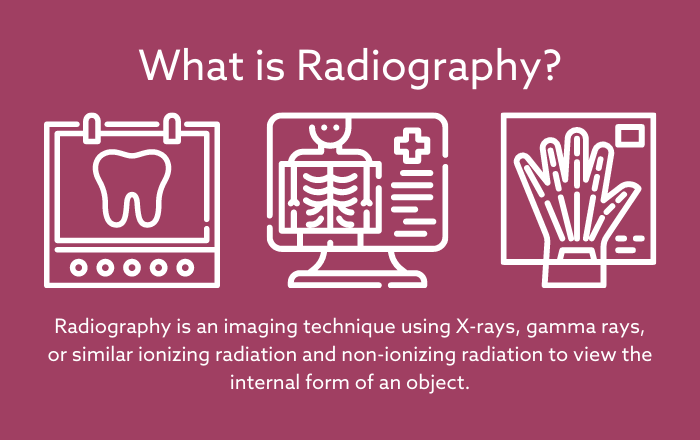 Radiography is an imaging technique using X-rays, gamma rays, or similar ionizing radiation and non-